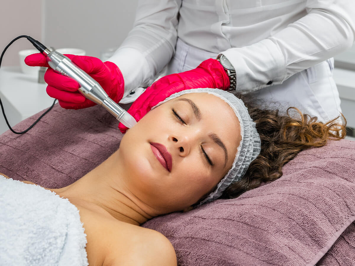 Microneedling